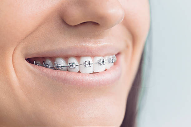 Best Crowns and Bridges  in Mchenry, IL